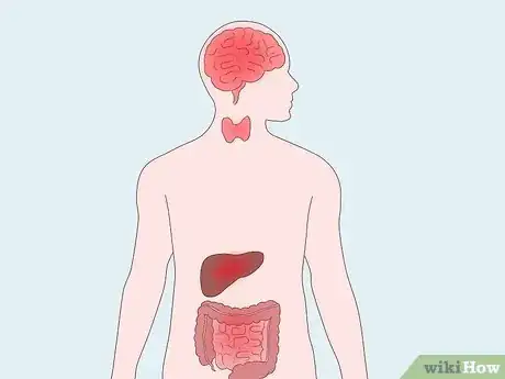 Image titled Prevent and Treat a Thyroid Storm Step 7