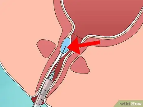 Image titled Avoid Bladder Leaks While Running Step 10