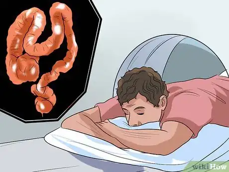 Image titled Screen for Colon Cancer Step 4