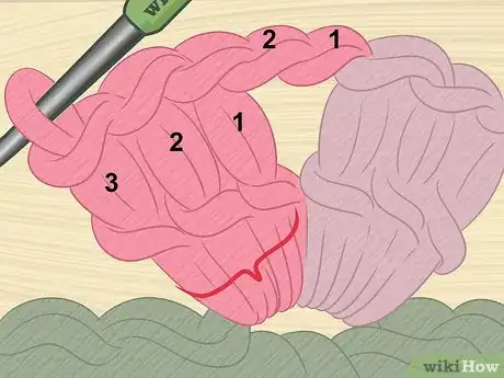 Image titled Crochet a Heart Stitch Step 10