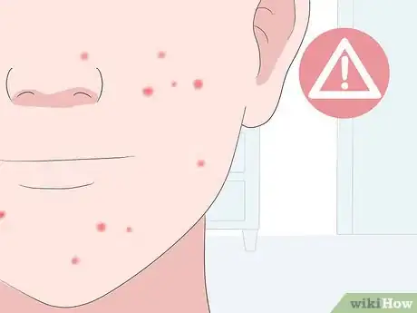 Image titled Come Off the Pill Safely Step 8