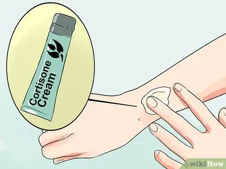 Image titled Treat Health Problems from Mold Step 7