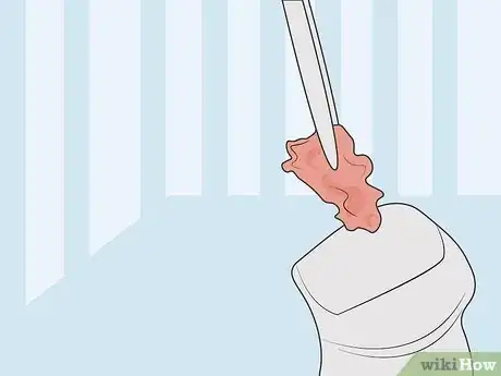 Image titled Diagnose Male Breast Disease Step 10