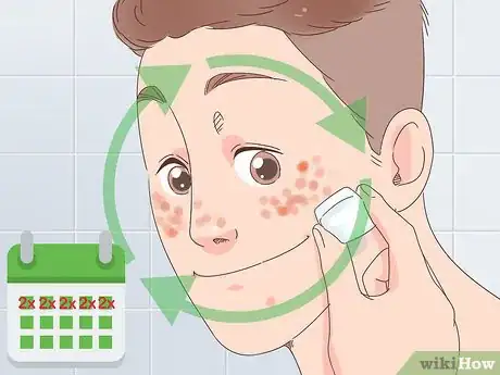 Image titled Get Clear Skin in 1 Week Step 10