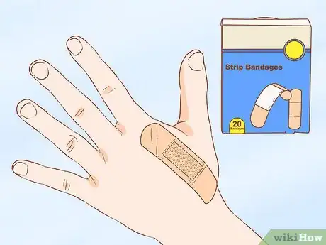 Image titled Apply Different Types of Bandages Step 1