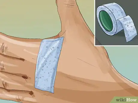 Image titled Pumice a Wart Step 8