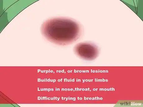 Image titled Diagnose Sarcoma Step 4