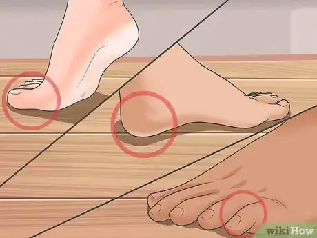 Image titled Prevent Knee Injuries in Ballet Step 8