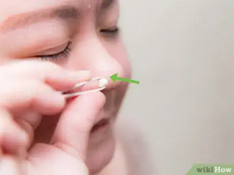 Image titled Fake a Facial Piercing Step 20