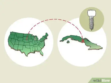 Image titled Find Low Cost Dental Implants Step 5