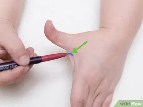 Image titled Fake a Facial Piercing Step 16