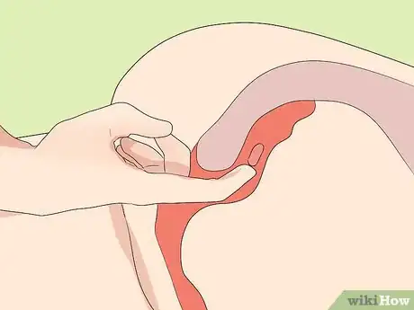 Image titled Manage Multiple Myeloma Pain Step 8