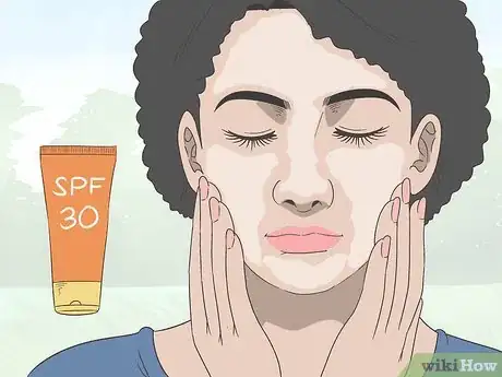 Image titled How to Treat Rosacea Can Herbal Remedies Help Step 10