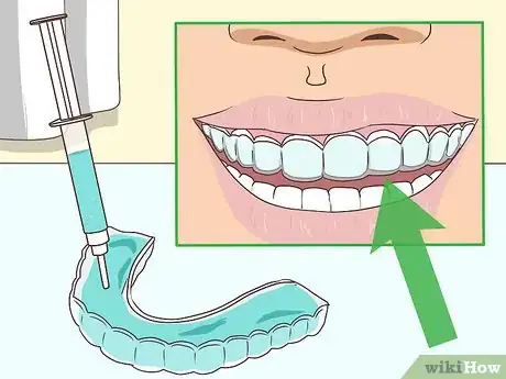 Image titled Cope with Teeth Whitening Sensitivity Step 3