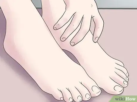 Image titled Treat a Broken Ankle Step 5