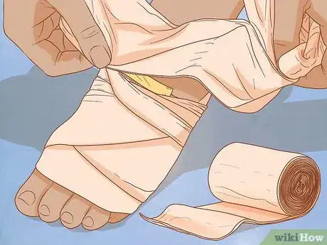 Image titled Apply Different Types of Bandages Step 9