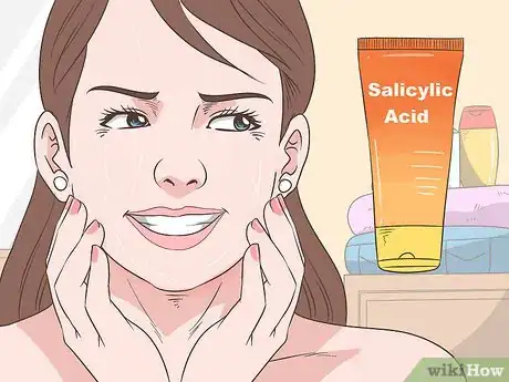 Image titled Avoid Adult Acne Step 4