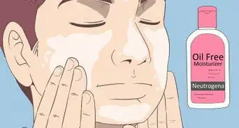 Get Rid of Acne if You Have Fair Skin