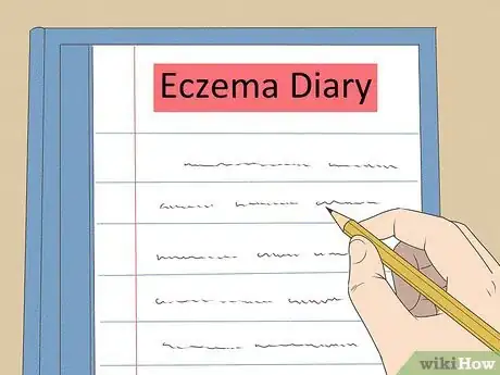Image titled Improve Eczema with Diet Step 4