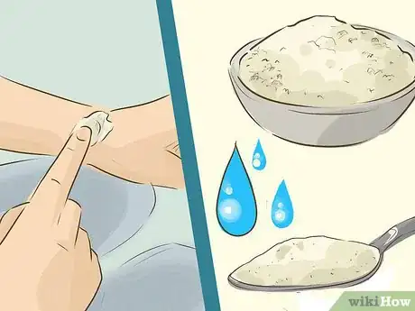 Image titled Stop Scratching a Mosquito Bite Step 8