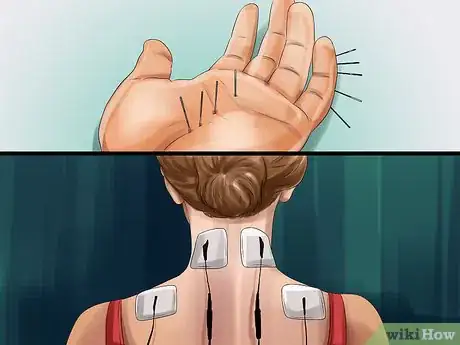 Image titled Treat Bone Spurs Step 15