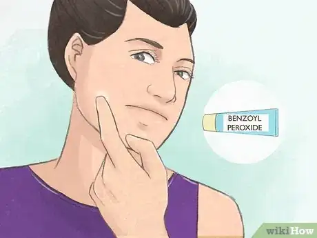 Image titled Prevent Cysts Step 7