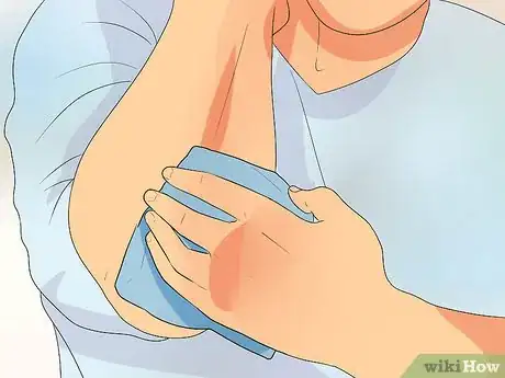 Image titled Cure Cracked and Dry Elbows Step 3