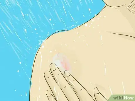 Image titled Treat Tumors Step 19