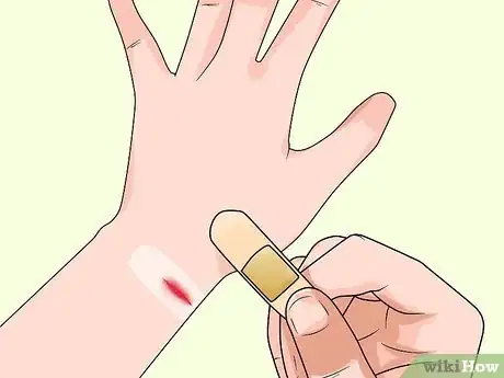 Image titled Know if You Have Sensitive Skin Step 9