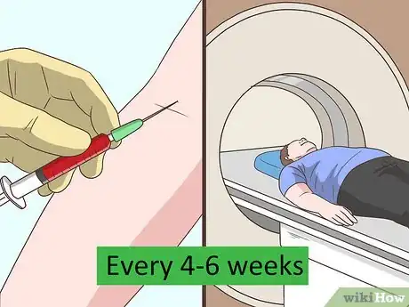 Image titled Treat IPF Step 22