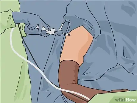 Image titled Fix Rotator Cuff Problems Step 17