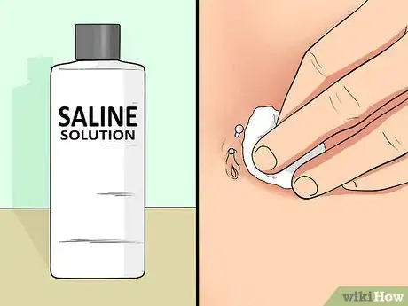 Image titled Treat an Irritated Belly Button Piercing Step 13