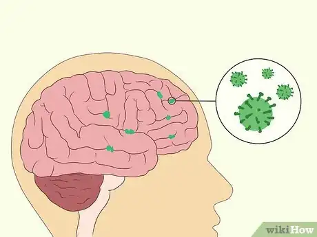 Image titled Treat Neurological Disorders Step 4