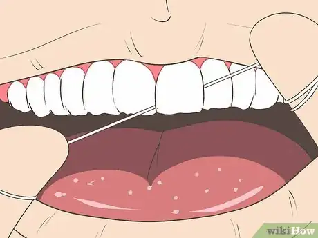 Image titled Avoid Hurting Your Gums Step 10