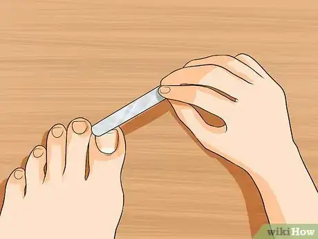 Image titled Get Rid of Yellow Toenails Step 15