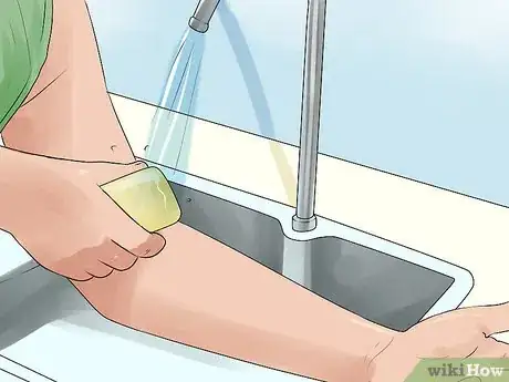 Image titled Recover from an Angioplasty Step 10