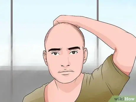 Image titled Choose the Right Hair Loss Option Step 14