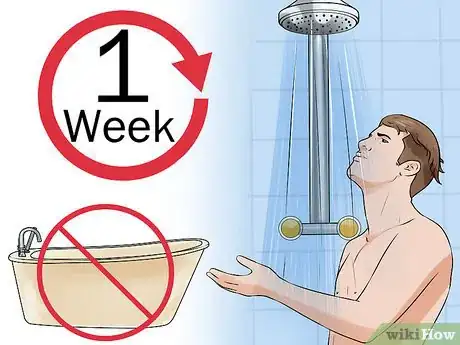 Image titled Recover from an Angioplasty Step 11