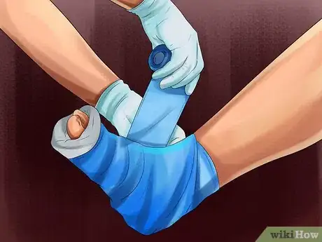 Image titled Treat Bone Spurs Step 14