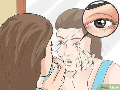 Image titled Reduce The Effects of Macular Degeneration Step 3