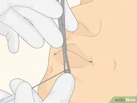 Image titled Get a Labret Piercing Step 12