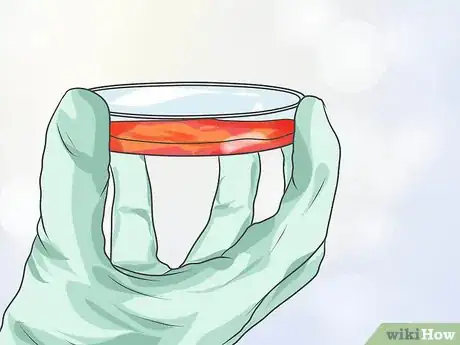 Image titled Spot Distributive Shock Symptoms Step 12