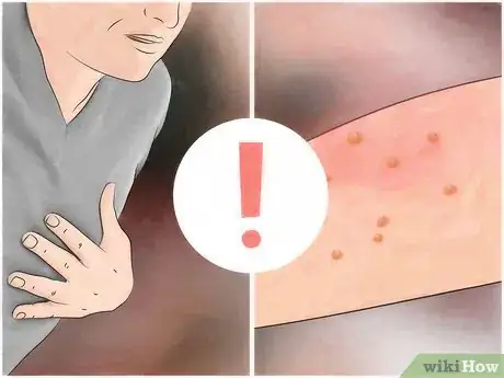 Image titled Identify Fire Ant Stings Step 3