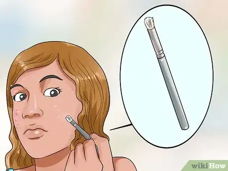 Image titled Hide Pimples Step 13