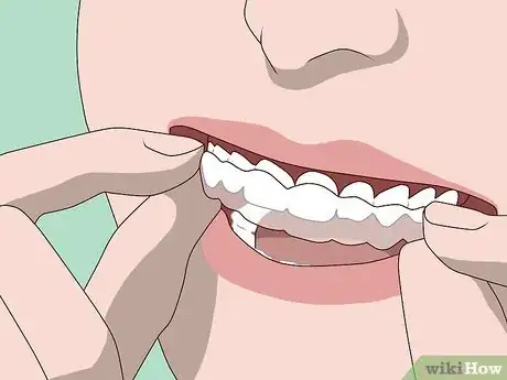Image titled Prevent Your Teeth from Falling Out Step 14