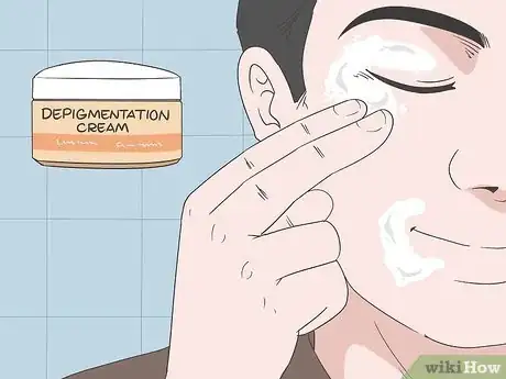 Image titled Diagnose and Treat Facial Vitiligo Step 7