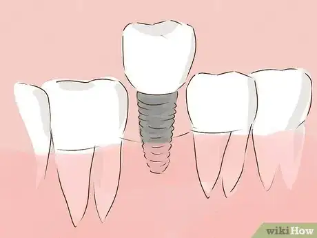 Image titled Treat Oral Cancer Step 4