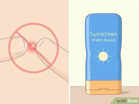 Image titled Treat Adult Acne Step 22