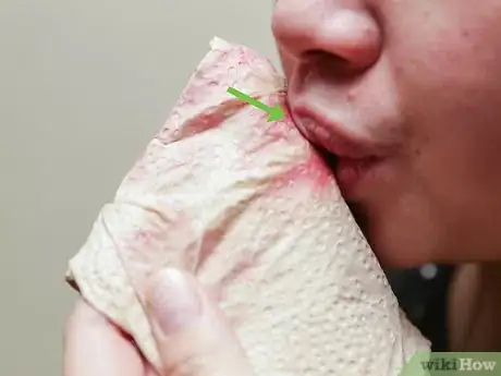 Image titled Get Rid of Acne Using Mint Leaves Step 11