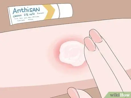 Image titled Treat Spider Bites on Kids Step 18